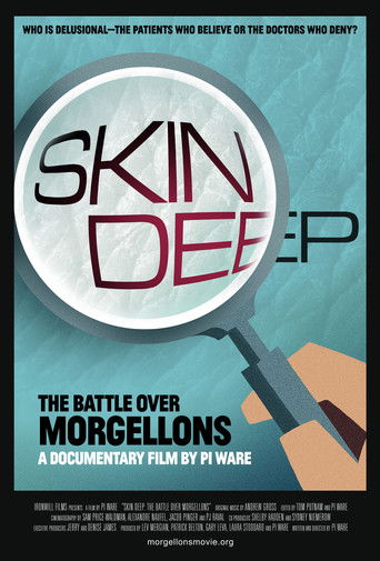 Watch Skin Deep: The Battle Over Morgellons 2019 poster